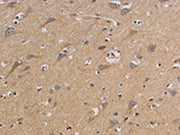 The image on the left is immunohistochemistry of paraffin-embedded Human brain tissue using CSB-PA171419(CCR2 Antibody) at dilution 1/20, on the right is treated with synthetic peptide. (Original magnification: ×200)