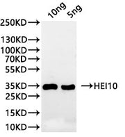 Western Blot Positive WB detected in: recombinant protein All lanes:HEI10 Antibody at 1:1000 Secondary Goat polyclonal to rabbit IgG at 1/20000 dilution Predicted band size: 30.1 kDa Observed band size: 36 kDa