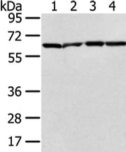 Gel: 6%SDS-PAGE, Lysate: 40 ug, Lane 1-4: Jurkat, hela, K562 and 231 cell, Primary antibody: CSB-PA171896(ATIC Antibody) at dilution 1/300 dilution, Secondary antibody: Goat anti rabbit IgG at 1/8000 dilution, Exposure time: 20 seconds