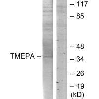 Western blot analysis of extracts from HT-29 cells, using TMEPA antibody.
