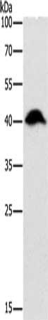 Gel: 10%SDS-PAGE, Lysate: 40 ug, Lane: Mouse intestinum tenue tissue, Primary antibody: CSB-PA172054(ADK Antibody) at dilution 1/200, Secondary antibody: Goat anti rabbit IgG at 1/8000 dilution, Exposure time: 10 minutes