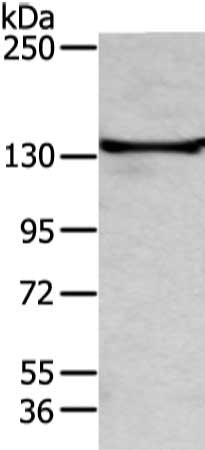 Gel: 6%SDS-PAGE, Lysate: 80 ug, Lane: 293T cell, Primary antibody: CSB-PA172074(TRIM24 Antibody) at dilution 1/400 dilution, Secondary antibody: Goat anti rabbit IgG at 1/8000 dilution, Exposure time: 1 minute