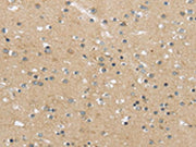 The image on the left is immunohistochemistry of paraffin-embedded Human brain tissue using CSB-PA172190(MPP6 Antibody) at dilution 1/25, on the right is treated with synthetic peptide. (Original magnification: ×200)