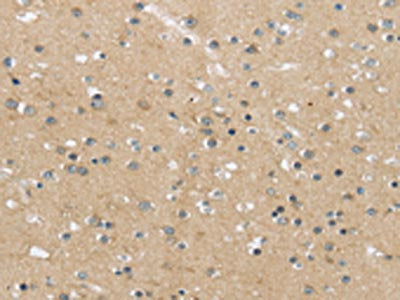 The image on the left is immunohistochemistry of paraffin-embedded Human brain tissue using CSB-PA172190(MPP6 Antibody) at dilution 1/25, on the right is treated with synthetic peptide. (Original magnification: ×200)