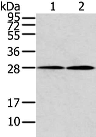 Gel: 12%SDS-PAGE, Lysate: 40 ug, Lane 1-2: Mouse heart and lung tissue, Primary antibody: CSB-PA172639(KCNMB1 Antibody) at dilution 1/500 dilution, Secondary antibody: Goat anti rabbit IgG at 1/8000 dilution, Exposure time: 15 seconds