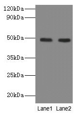 Western blot All lanes: NEU3 antibody at 2µg/ml Lane 1: A549 whole cell lysate Lane 2: U251 whole cell lysate Secondary Goat polyclonal to rabbit IgG at 1/10000 dilution Predicted band size: 49, 52 kDa Observed band size: 49 kDa