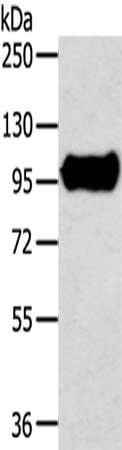 Gel: 6%SDS-PAGE,Lysate: 40 ug,,Primary antibody: CSB-PA173135(TRIM71 Antibody) at dilution 1/300 dilution,Secondary antibody: Goat anti rabbit IgG at 1/8000 dilution,Exposure time: 20 seconds