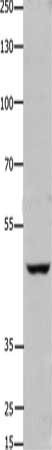 Gel: 8%SDS-PAGE, Lysate: 40 ug, Lane: Hela cells, Primary antibody: CSB-PA173245(FOXD3 Antibody) at dilution 1/450, Secondary antibody: Goat anti rabbit IgG at 1/8000 dilution, Exposure time: 1 minute
