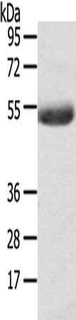 Gel: 8%SDS-PAGE, Lysate: 40 ug, Lane: Mouse plasma tissue, Primary antibody: CSB-PA173647(AGPAT6 Antibody) at dilution 1/400, Secondary antibody: Goat anti rabbit IgG at 1/8000 dilution, Exposure time: 5 minutes