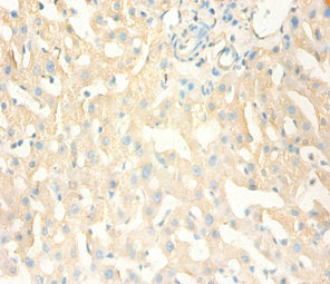 Immunohistochemistry of paraffin-embedded human liver tissue using CSB-PA17374A0Rb at dilution of 1:100