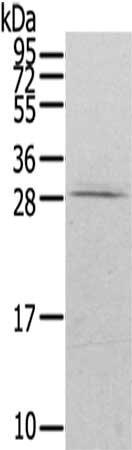 Gel: 12%SDS-PAGE,Lysate: 40 ug,,Primary antibody: CSB-PA173917(RAB20 Antibody) at dilution 1/200 dilution,Secondary antibody: Goat anti rabbit IgG at 1/8000 dilution,Exposure time: 30 seconds