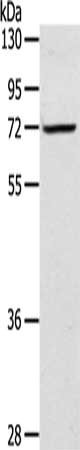 Gel: 8%SDS-PAGE, Lysate: 40 ug, Lane: TM4 cells, Primary antibody: CSB-PA173934(LTA4H Antibody) at dilution 1/300, Secondary antibody: Goat anti rabbit IgG at 1/8000 dilution, Exposure time: 20 seconds