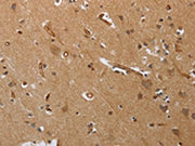 The image on the left is immunohistochemistry of paraffin-embedded Human brain tissue using CSB-PA174197(PODXL Antibody) at dilution 1/20, on the right is treated with synthetic peptide. (Original magnification: ×200)