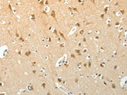 The image on the left is immunohistochemistry of paraffin-embedded Human brain tissue using CSB-PA174241(SCG3 Antibody) at dilution 1/15, on the right is treated with fusion protein. (Original magnification: ×200)