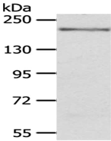 Gel: 6%SDS-PAGE,Lysate: 40 ug,,Primary antibody: CSB-PA174245(KDM6B Antibody) at dilution 1/200 dilution,Secondary antibody: Goat anti rabbit IgG at 1/8000 dilution,Exposure time: 10 minutes