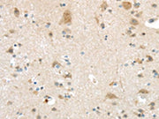 The image on the left is immunohistochemistry of paraffin-embedded Human brain tissue using CSB-PA174683(VSIG10 Antibody) at dilution 1/45, on the right is treated with synthetic peptide. (Original magnification: ×200)