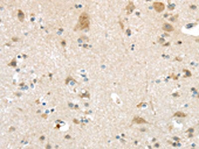 The image on the left is immunohistochemistry of paraffin-embedded Human brain tissue using CSB-PA174683(VSIG10 Antibody) at dilution 1/45, on the right is treated with synthetic peptide. (Original magnification: ×200)