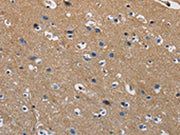 The image on the left is immunohistochemistry of paraffin-embedded Human brain tissue using CSB-PA174920(GSTA2 Antibody) at dilution 1/50, on the right is treated with fusion protein. (Original magnification: ×200)