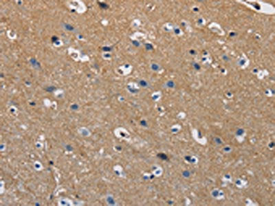 The image on the left is immunohistochemistry of paraffin-embedded Human brain tissue using CSB-PA174920(GSTA2 Antibody) at dilution 1/50, on the right is treated with fusion protein. (Original magnification: ×200)