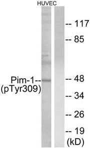 Western blot analysis of extracts from HUVEC cells treated with PMA using Pim-1 (Phospho-Tyr309) Antibody.The lane on the right is treated with the antigen-specific peptide.