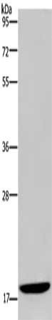 Gel: 10%SDS-PAGE, Lysate: 40 ug, Lane: Hela cells, Primary antibody: CSB-PA175335(KLLN Antibody) at dilution 1/350, Secondary antibody: Goat anti rabbit IgG at 1/8000 dilution, Exposure time: 2 minutes