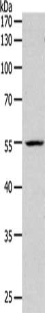 Gel: 10%SDS-PAGE, Lysate: 40 ug, Lane: K562 cells, Primary antibody: CSB-PA175675(PAX1 Antibody) at dilution 1/1200, Secondary antibody: Goat anti rabbit IgG at 1/8000 dilution, Exposure time: 2 minutes