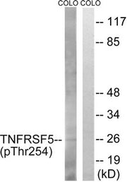 Western blot analysis of extracts from COLO cells, treated with Insulin (0.01U/ml, 15mins), using TNFRSF5 (Phospho-Thr254) antibody. The lane on the right is treated with the synthesized peptide.