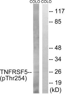 Western blot analysis of extracts from COLO cells, treated with Insulin (0.01U/ml, 15mins), using TNFRSF5 (Phospho-Thr254) antibody. The lane on the right is treated with the synthesized peptide.