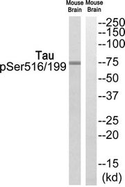 Western blot analysis of extracts from Mouse brain cells, using Tau (Phospho-Ser516/199) antibody. The lane on the right is treated with the synthesized peptide.