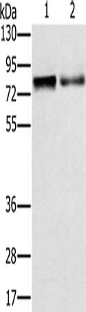 Gel: 8%SDS-PAGE, Lysate: 40 ug, Lane 1-2: Mouse fat tissue, Mouse spleen tissue, Primary antibody: CSB-PA176274(ZBTB16 Antibody) at dilution 1/400, Secondary antibody: Goat anti rabbit IgG at 1/8000 dilution, Exposure time: 2 minutes