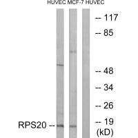 Western blot analysis of extracts from HUVEC cells and MCF-7 cells, using RPS20 antibody.