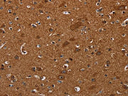 The image on the left is immunohistochemistry of paraffin-embedded Human brain tissue using CSB-PA176464(CYBB Antibody) at dilution 1/40, on the right is treated with synthetic peptide. (Original magnification: ×200)