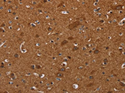 The image on the left is immunohistochemistry of paraffin-embedded Human brain tissue using CSB-PA176464(CYBB Antibody) at dilution 1/40, on the right is treated with synthetic peptide. (Original magnification: ×200)