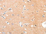 The image on the left is immunohistochemistry of paraffin-embedded Human brain tissue using CSB-PA176985(MAPK8 Antibody) at dilution 1/50, on the right is treated with synthetic peptide. (Original magnification: ×200)