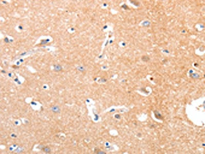 The image on the left is immunohistochemistry of paraffin-embedded Human brain tissue using CSB-PA176985(MAPK8 Antibody) at dilution 1/50, on the right is treated with synthetic peptide. (Original magnification: ×200)