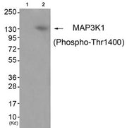 Western blot analysis of extracts from JK cells (Lane 2), using MAP3K1 (Phospho-Thr1400) Antibody. The lane on the left is treated with antigen-specific peptide.