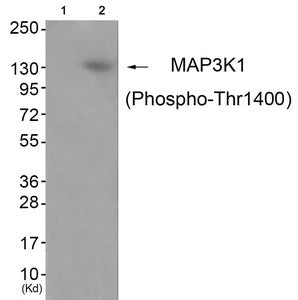 Western blot analysis of extracts from JK cells (Lane 2), using MAP3K1 (Phospho-Thr1400) Antibody. The lane on the left is treated with antigen-specific peptide.