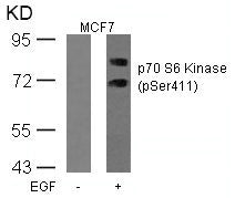 Western blot analysis of extracts from MCF cells untreated or treated with EGF using p70 S6 Kinase(Phospho-Ser411) Antibody.