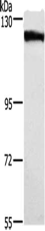 Gel: 6%SDS-PAGE, Lysate: 40 ug, Lane: Human tongue cancer tissue, Primary antibody: CSB-PA177422(DSG1 Antibody) at dilution 1/750, Secondary antibody: Goat anti rabbit IgG at 1/8000 dilution, Exposure time: 2 minutes
