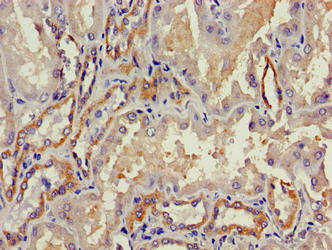 Immunohistochemistry of paraffin-embedded human kidney tissue using CSB-PA17749A0Rb at dilution of 1:100