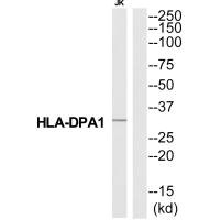 Western blot analysis of extracts from Jurkat cells, using HA2Q antibody.