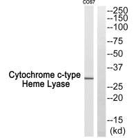 Western blot analysis of extracts from COS7 cells, using Cytochrome c-type Heme Lyase antibody.