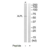 Western blot analysis of extracts from Jurkat cells, using ALPL antibody.