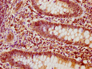 IHC image of CSB-PA17827A0Rb diluted at 1:1200 and staining in paraffin-embedded human appendix tissue performed on a Leica BondTM system. After dewaxing and hydration, antigen retrieval was mediated by high pressure in a citrate buffer (pH 6.0)....