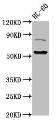 Western Blot Positive WB detected in: HL60 whole cell lysate All lanes: KAT5 antibody at 3ug/ml Secondary Goat polyclonal to rabbit IgG at 1/50000 dilution Predicted band size: 59, 54, 62, 57 kDa Observed band size: 59 kDa