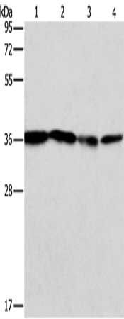 Gel: 10%SDS-PAGE, Lysate: 40 ug, Lane 1-4: Hela cells, Jurkat cells, 293T cells, K562 cells, Primary antibody: CSB-PA178504(NFKBIA Antibody) at dilution 1/84, Secondary antibody: Goat anti rabbit IgG at 1/8000 dilution, Exposure time: 10 seconds