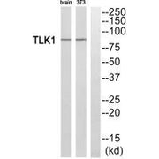Western blot analysis of extracts from rat brain cells and NIH/3T3 cells, using TLK1 antibody.