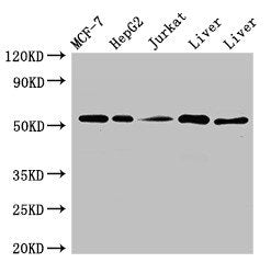 Western Blot Positive WB detected in: MCF-7 whole cell lysate, HepG2 whole cell lysate, Jurkat whole cell ltysate, Mouse liver tissue, Rat liver tissue All lanes: KAT8 antibody at 3ug/ml Secondary Goat polyclonal to rabbit IgG at 1/50000 dilution...