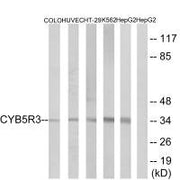 Western blot analysis of extracts from COLO cells, HUVEC cells, HT-29 cells, K562 cells and HepG2 cells, using CYB5R3 antibody.