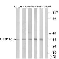 Western blot analysis of extracts from COLO cells, HUVEC cells, HT-29 cells, K562 cells and HepG2 cells, using CYB5R3 antibody.